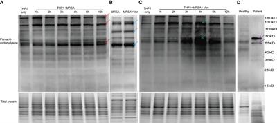 Systematic analysis of lysine crotonylation in human macrophages responding to MRSA infection